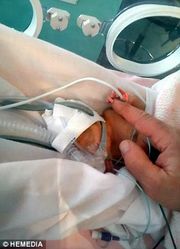 Ενα πρόωρο μωρό γίνεται «μικρό θαύμα» και μάθημα ζωής για όλους (φωτογραφίες)
