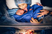 Υπέροχες φωτογραφίες καισαρικής τομής που δείχνουν πόσο δυνατή είναι μια μαμά