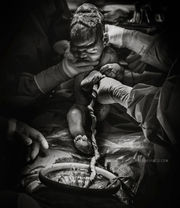 Υπέροχες φωτογραφίες καισαρικής τομής που δείχνουν πόσο δυνατή είναι μια μαμά