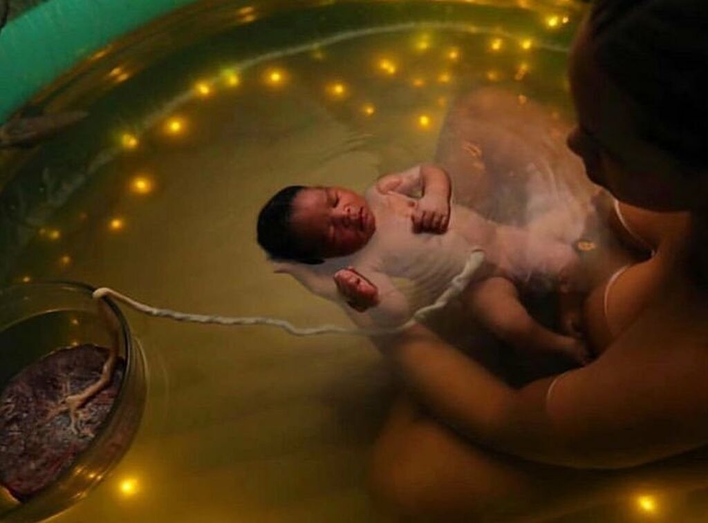 Γέννα στο νερό: Απίθανες φωτογραφίες με μωράκια που γεννιούνται σε πισίνες (pics)