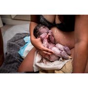 Η μαγεία του εμβρυϊκού σμήγματος (Vernix Caseosa) μέσα από φωτογραφίες (pics)