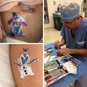 Παιδοχειρουργός βρήκε έναν απίστευτο τρόπο να κάνει χαρούμενα τα παιδιά μετά από μια επέμβαση (pics)