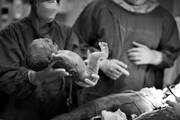 Νεογέννητο με εμβρυικό σμήγμα που μόλις έχει γεννηθεί  - Πηγή φωτογραφίας: Instagram / joanna.macedo.photos