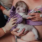 Μωράκι γεννιέται με το εμβρυικό σμήγμα - Instagram  / laurenanddouglas.birth