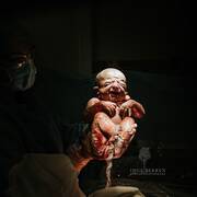Ομφάλιος λώρος και εμβρυικό σμήγμα σε πρώτο πλάνο (Φωτογραφία instagram @ingefotografie.nl )