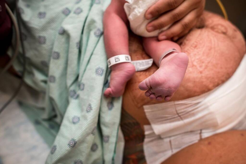 Μαμά με καλυμμένη τομή κρατά στην αγκαλιά της το νεογέννητο μωρό της - Πηγή φωτογραφίας: Instagram / monetnicolebirths