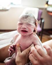 Νεογέννητο με το εμβρυικό σμήγμα - Πηγή φωτογραφίας: Instagram / monetnicolebirths