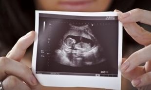 Μωρό επιβίωσε από έκτρωση που έγινε με χρήση χημικών