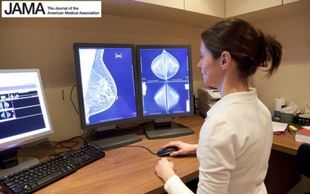Πιο αποτελεσματική η τρισδιάστατη μαστογραφία στον έγκαιρο εντοπισμό του καρκίνου