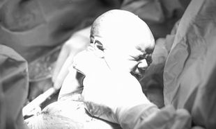 Καισαρική: Δείτε τη γέννα καρέ καρέ μέσα από ένα εκπληκτικό φωτογραφικό άλμπουμ