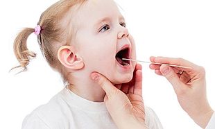 Αφθώδης στοματίτιδα στα παιδιά-Όλα όσα πρέπει να γνωρίζουμε