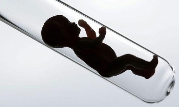 Εξωσωματική γονιμοποίηση: Όλα όσα πρέπει να γνωρίζετε από τον γυναικολόγο του Mothersblog