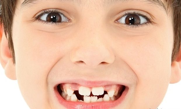 Οι πολλοί χυμοί καταστρέφουν τα δόντια των παιδιών