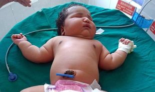 Είναι το βαρύτερο κοριτσάκι που έχει γεννηθεί-Δεν θα πιστεύετε πόσα κιλά ζυγίζει ( βίντεο)