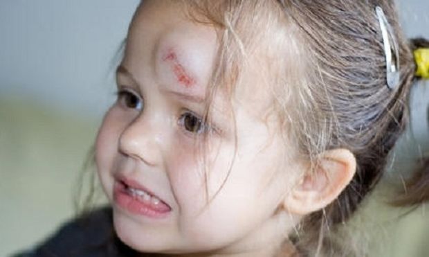 Χτύπημα στο κεφάλι του παιδιού: Πότε πρέπει να ανησυχούμε