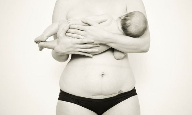 Τι πιθανότητα έχει μια γυναίκα να γεννήσει με κολπικό τοκετό μετά από καισαρική τομή;