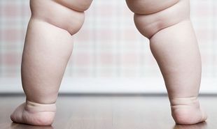 Tρεις νέοι παράγοντες συμβάλλουν στην παιδική παχυσαρκία