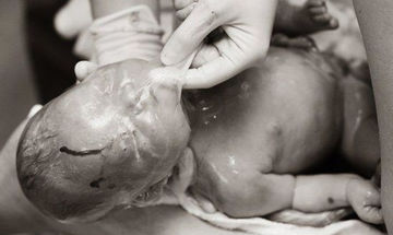 Εn-caul γέννηση ή αλλιώς γέννηση σε αμνιακό σάκο - Ένα εξαιρετικά σπάνιο φαινόμενο μέσα από 22 φώτο
