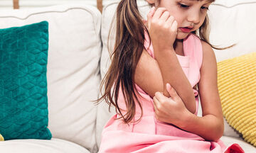 Ατοπική δερματίτιδα - Έκζεμα: όλα όσα πρέπει να γνωρίζουν οι γονείς σε ένα άρθρο