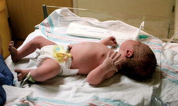 Αλλάζοντας πάνες στα νεογέννητα φροντίδα του ομφάλιου λώρου