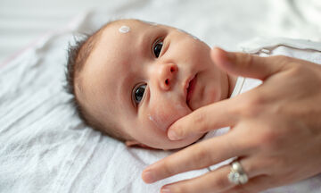 Κοκκινίλες στο δέρμα του μωρού: Οι πιο συνήθεις αιτίες & η αντιμετώπιση