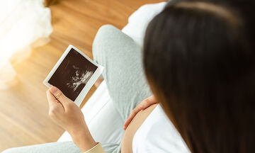 Μονήρης ομφαλική αρτηρία: Τι είναι και ποιες οι επιπτώσεις στο έμβρυο; 