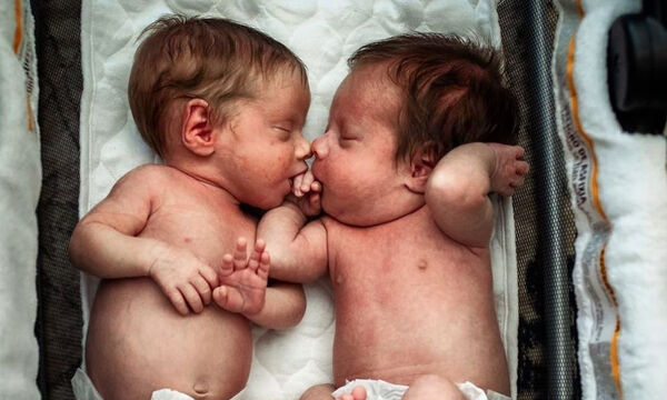 Αυτή η φωτογραφία των δίδυμων μωρών με το χέρι στο στόμα έγινε viral 