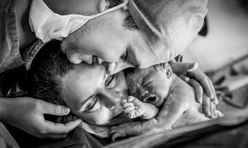 Η στιγμή που ένα μωρό γεννιέται - Δείτε απίθανες φωτογραφίες τοκετού