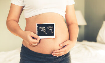 Αιμορροΐδες στην εγκυμοσύνη: Τι πρέπει να γνωρίζετε
