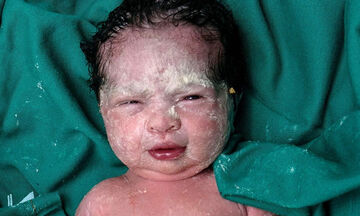 Νεογέννητα μωράκια φωτογραφίζονται με το εμβρυικό σμήγμα 