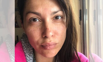 Κλέλια Ρένεση: Η κόρη της τη γέμισε αυτοκόλλητα (εικόνες)