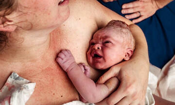 Πώς αλλάζει το κεφάλι του μωρού κατά τη διάρκεια του φυσιολογικού τοκετού;