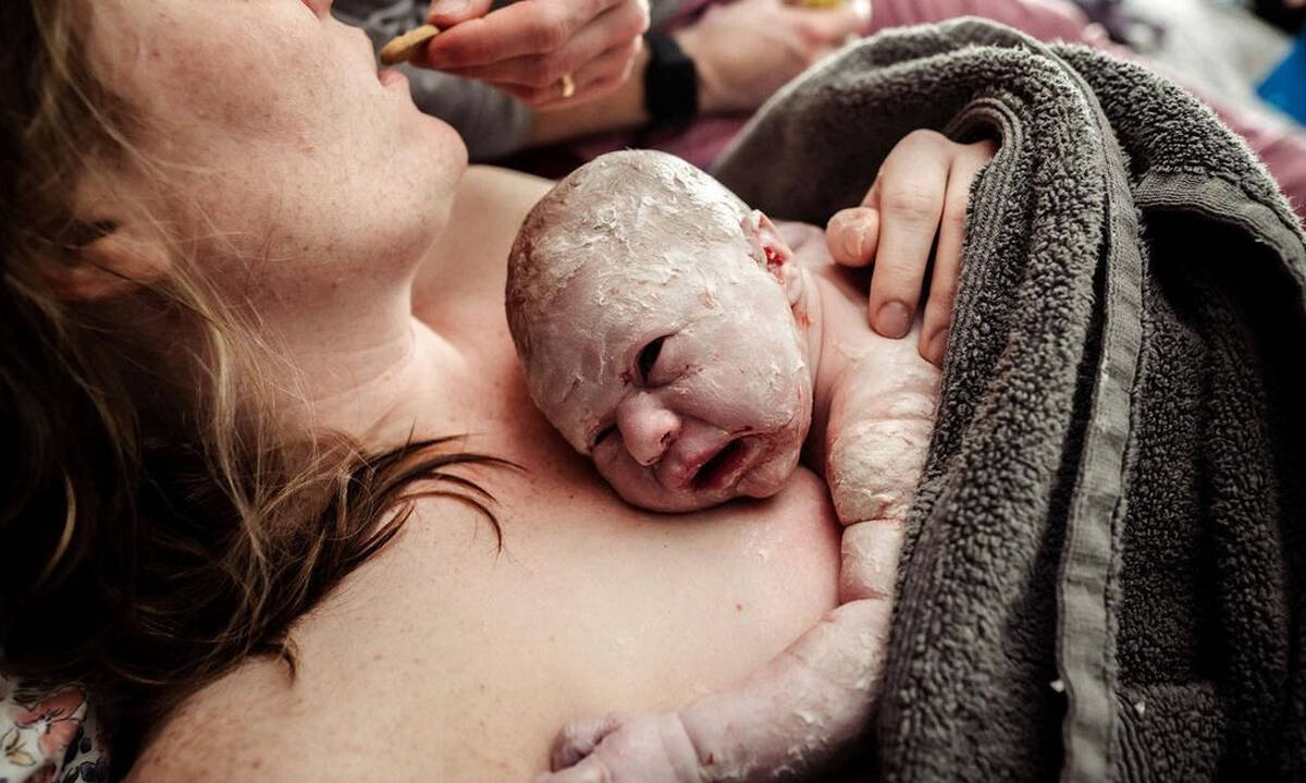 Vernix Caseosa: Φωτογραφίες μωρών με το εμβρυικό σμήγμα (εικόνες)