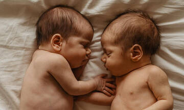 Οι πιο όμορφες φωτογραφίες δίδυμων νεογέννητων είναι αυτές (εικόνες)